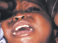 Photo from archived article: photos/1058/health1_1