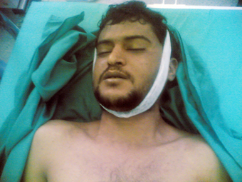 Yemeni illegal migrants to Saudi Arabia, including this man, have claimed that Saudi police set fire to the hole in the ground where they were hiding.