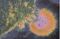 Photo from archived article: photos/972/health1_2